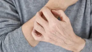 استرس جنگ و افزایش خشکی و التهاب پوست/توصیه های طب ایرانی برای محافظت از پوست